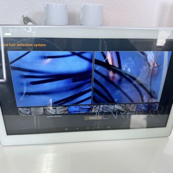 M Head Spa - Before & after scalp assessment - Hair Loss Centers Near Me - Rosemead, California M Head Spa - Before & after scalp assessment - Hair Loss Centers Near Me - Rosemead, California