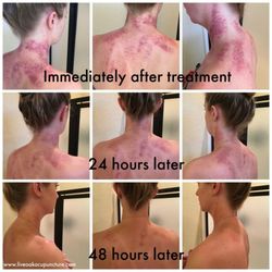 Relax Spa - Gua Sha