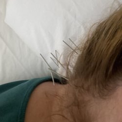 Acupuncture & Healing Arts Medical Group