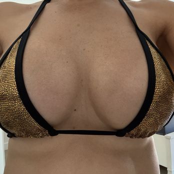 Stephen Bresnick, MD - 9 years post surgery! So beautiful! - Cosmetic Surgeons Near Me - Encino, California