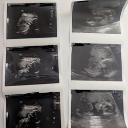 Harbinder Brar MD - Dr. Brar's terrible ultrasound pictures on the right hand side.