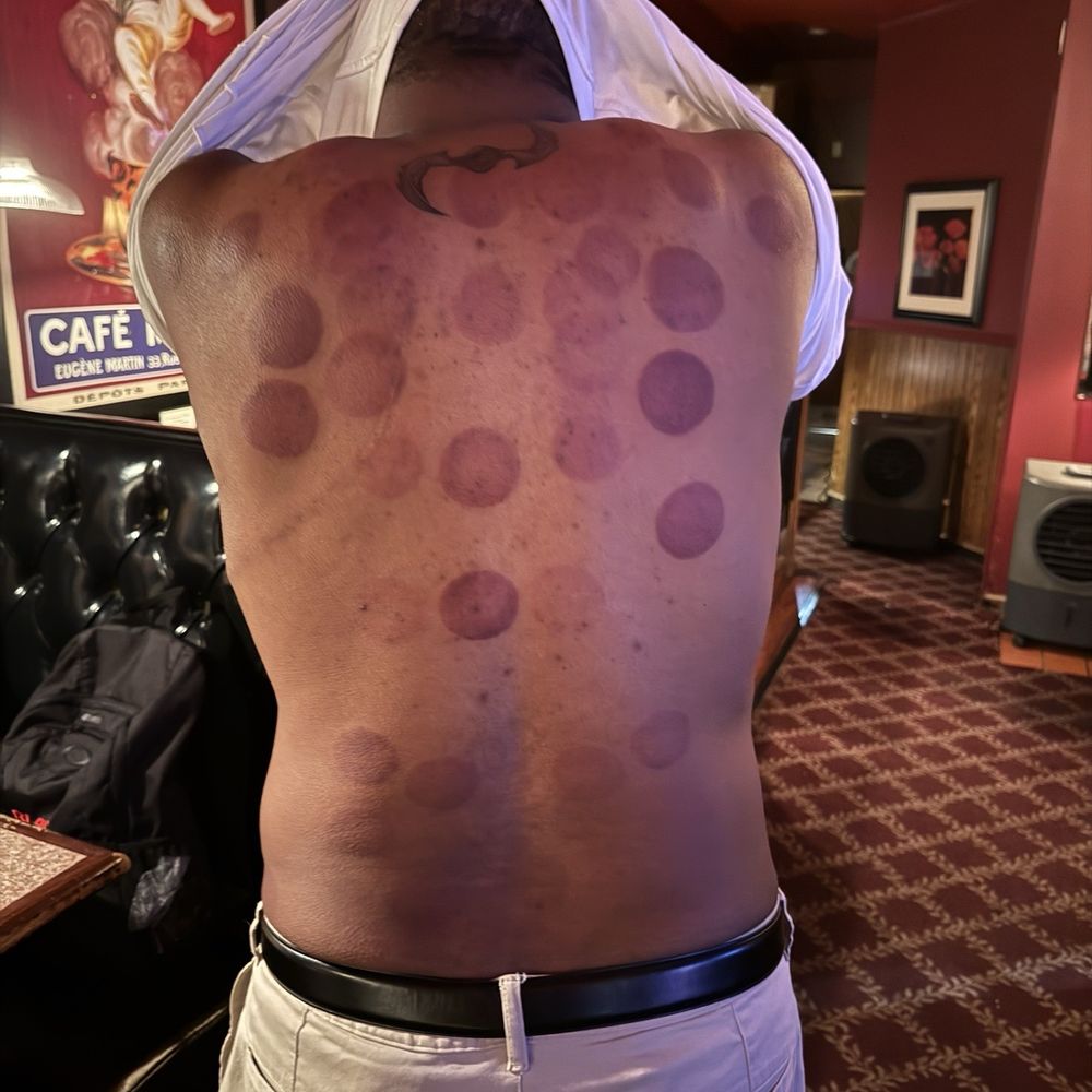 TOP 10 BEST B12 Injections in Denver, CO - (2026 Guide) - Quality & Affordability