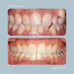 My LA Braces - Creating beautiful smiles, one patient at a time!