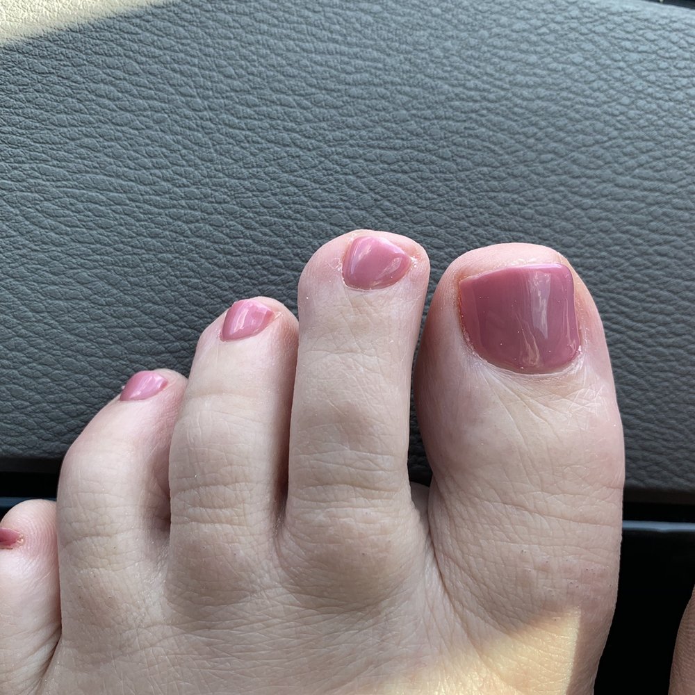 Nail Envogue - Uneven toenails - Nail Salons Near Me - Lexington, Kentucky Nail Envogue - Uneven toenails - Nail Salons Near Me - Lexington, Kentucky