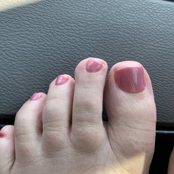 Nail Envogue - Uneven toenails - Nail Salons Near Me - Lexington, Kentucky Nail Envogue - Uneven toenails - Nail Salons Near Me - Lexington, Kentucky