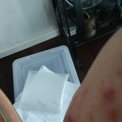 Advanced Allergy & Asthma – Sewickley