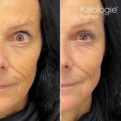 Kalologie Medspa Paradise Valley