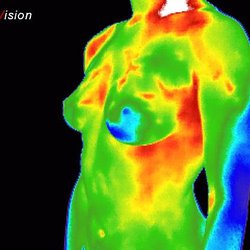 Creative Wellness - Thermography