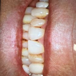 Oak Tree Dental - Before