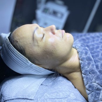 Meraki Skin Solutions - Skin Care Near Me Meraki Skin Solutions - Skin Care Near Me