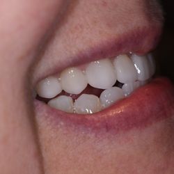 General Dentistry In Denton Yelp