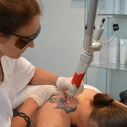 Renude Laser Tattoo Removal - Sydney Tattoo Removal