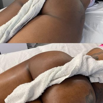 Noir Body Lab - Body Contouring Near Me