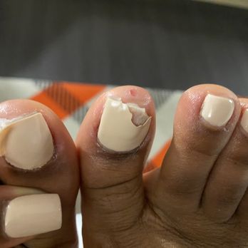 LUV Nails & Spa - Poor quality gel pedi. Peeling polish that wasn't fully dried. Punctured skin during pedi! - Nail Salons Near Me - Bellflower, California LUV Nails & Spa - Poor quality gel pedi. Peeling polish that wasn't fully dried. Punctured skin during pedi! - Nail Salons Near Me - Bellflower, California