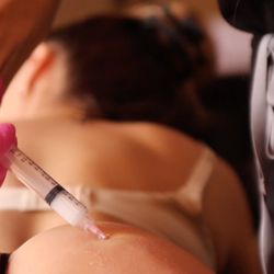 True Med Spa - Radiesse booty enhancement!