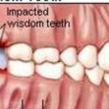 Jessen Oral Surgery - Oral Surgeons Near Me - South Ogden, Utah Jessen Oral Surgery - Oral Surgeons Near Me - South Ogden, Utah
