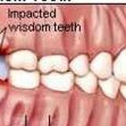 Jessen Oral Surgery