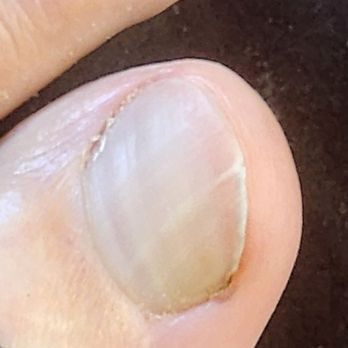 Kay Kare Nails - The quality of my unfinished pedicure. - Nail Salons Near Me - Littleton, Colorado Kay Kare Nails - The quality of my unfinished pedicure. - Nail Salons Near Me - Littleton, Colorado