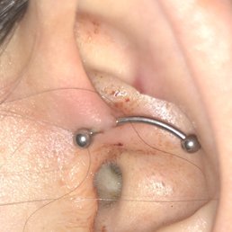 This is the worst daith piercing I have ever seen This is the worst daith piercing I have ever seen