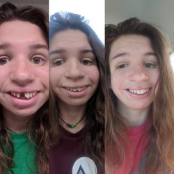 East Highlands Dentistry - I Got Teeth!