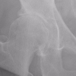 Southeast Orthopedic Specialists - Fleming Island - Before
