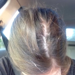 Top of my hair.
