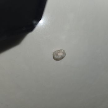 Laguna Endodontics - My crown - Endodontists Near Me - Elk Grove, California