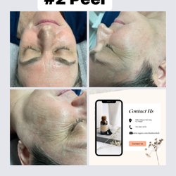 The Skin Rehab
