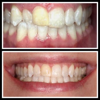 Smiles By Dr. Leila - General Dentistry Near Me - Poway, California Smiles By Dr. Leila - General Dentistry Near Me - Poway, California