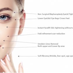 Sculptica Aesthetics - Fibroblast