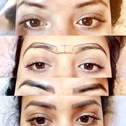Top to bottom: before, marked up, after first session, after second session Top to bottom: before, marked up, after first session, after second session