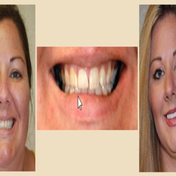 Avant Dental Group - General Dentistry Near Me - Kissimmee, Florida Avant Dental Group - General Dentistry Near Me - Kissimmee, Florida