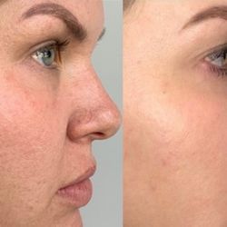 Juvon Skincare & Wellness