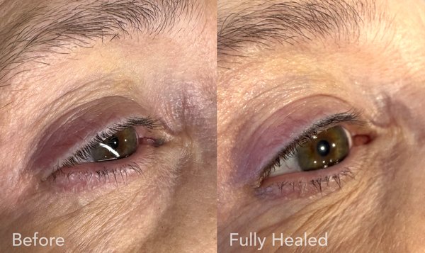 Permanent Eyeliner - Permanent Eyeliner for easy every day!
Lash enhancement eyeliner is a subtle permanent makeup technique that adds pigment right along the lash line. It creates the illusion of fuller lashes and softly defined eyes—no harsh line, just a natural boost that stays fresh all day every day! Call +15047881340 Permanent Eyeliner - Permanent Eyeliner for easy every day!
Lash enhancement eyeliner is a subtle permanent makeup technique that adds pigment right along the lash line. It creates the illusion of fuller lashes and softly defined eyes—no harsh line, just a natural boost that stays fresh all day every day! Call +15047881340