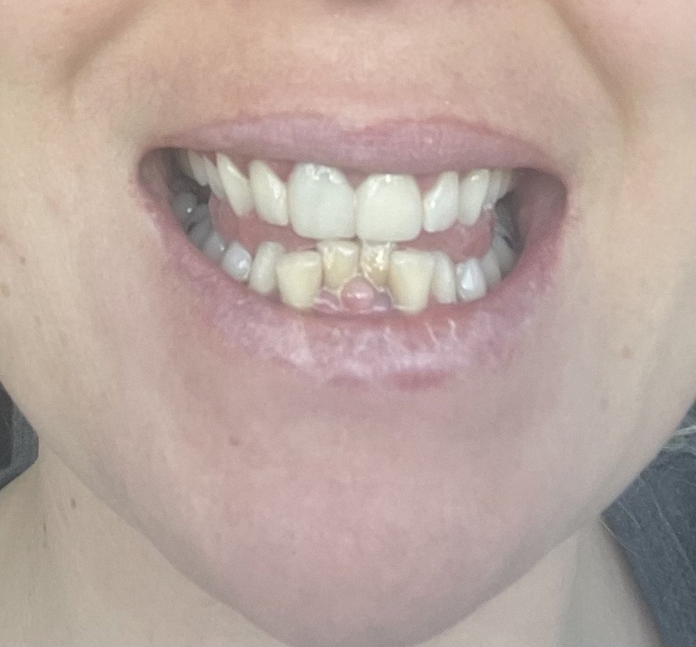 CRESCENT PROSTHODONTICS Updated September 2024 1821 Gadsden St