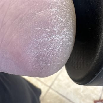 Adora Nails Spa - Dry feet leaving. No callous removal. - Nail Salons Near Me - Shorewood, Illinois Adora Nails Spa - Dry feet leaving. No callous removal. - Nail Salons Near Me - Shorewood, Illinois