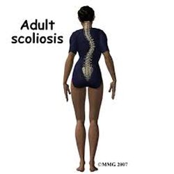 The Arcade Chiropractic Clinic - pretty much what i have