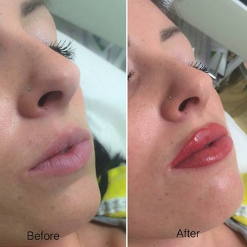 Majestic Face and Body - Lip blush - Permanent Makeup Near Me - Spring, Texas Majestic Face and Body - Lip blush - Permanent Makeup Near Me - Spring, Texas