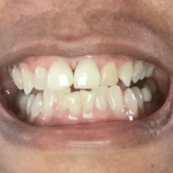 Indigo Dentistry - Before