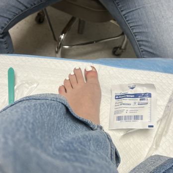 Nail Genie - Toe infection - Nail Salons Near Me - Union City, California Nail Genie - Toe infection - Nail Salons Near Me - Union City, California