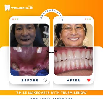 TruSmile Now - General Dentistry Near Me - Peoria, Arizona TruSmile Now - General Dentistry Near Me - Peoria, Arizona