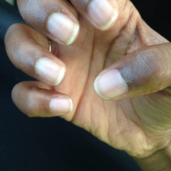 Great Nails & Spa - And this was AFTER the manicure..horrible. I do not recommend. - Nail Salons Near Me - Austin, Texas Great Nails & Spa - And this was AFTER the manicure..horrible. I do not recommend. - Nail Salons Near Me - Austin, Texas
