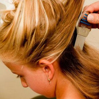 Lice Lifters - Combing through the hair to find evidence of lice. - Lice Services Near Me - Cranford, New Jersey Lice Lifters - Combing through the hair to find evidence of lice. - Lice Services Near Me - Cranford, New Jersey