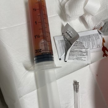 Cypress Orthopedics - Needle with fluid - Orthopedists Near Me - Houston, Texas Cypress Orthopedics - Needle with fluid - Orthopedists Near Me - Houston, Texas