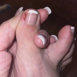 Cut during a pedicure and two days later still hurting Cut during a pedicure and two days later still hurting
