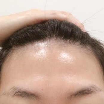 Skin Solutions - Skin Care Near Me - Flushing, New York Skin Solutions - Skin Care Near Me - Flushing, New York