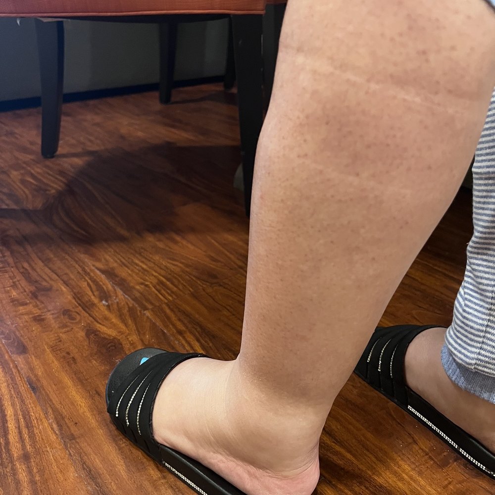 BodyContourz - After 5 days of giving birth - Body Contouring Near Me - Costa Mesa, California BodyContourz - After 5 days of giving birth - Body Contouring Near Me - Costa Mesa, California