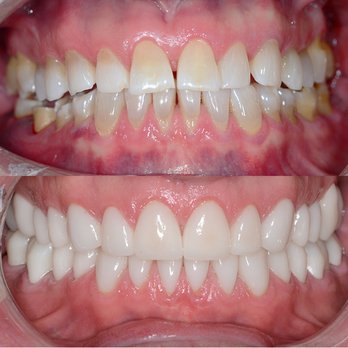 Boulder Canyon Dental - Orthodontists Near Me - Boulder, Colorado Boulder Canyon Dental - Orthodontists Near Me - Boulder, Colorado