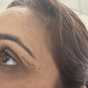 Sun Nails & Hair - Burnt area below my eyebrow after eyebrow waxing - Nail Salons Near Me - San Jose, California Sun Nails & Hair - Burnt area below my eyebrow after eyebrow waxing - Nail Salons Near Me - San Jose, California