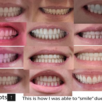 Affordable Dentures & Implants - Affordable's attempts - Prosthodontists Near Me - Cypress, Texas